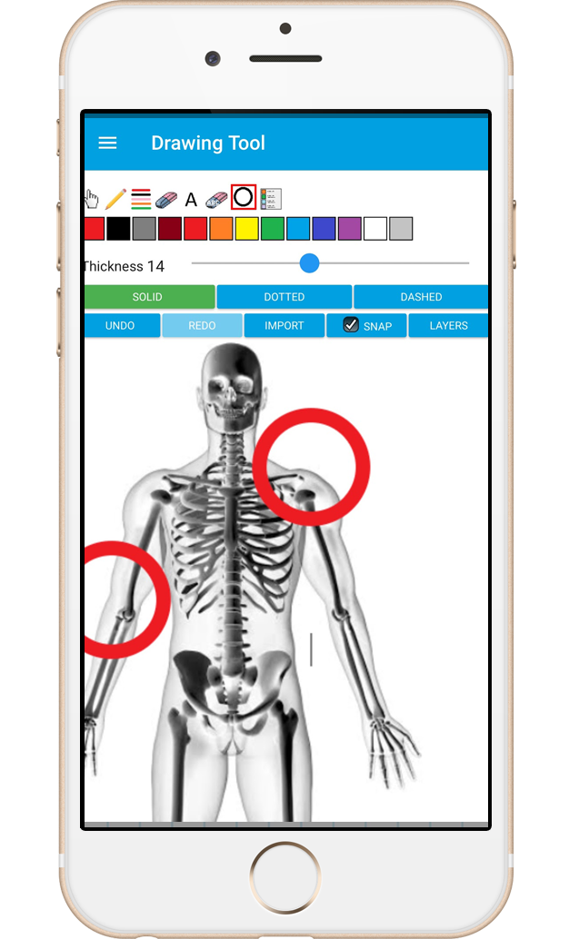 Medical Charts in Formitize